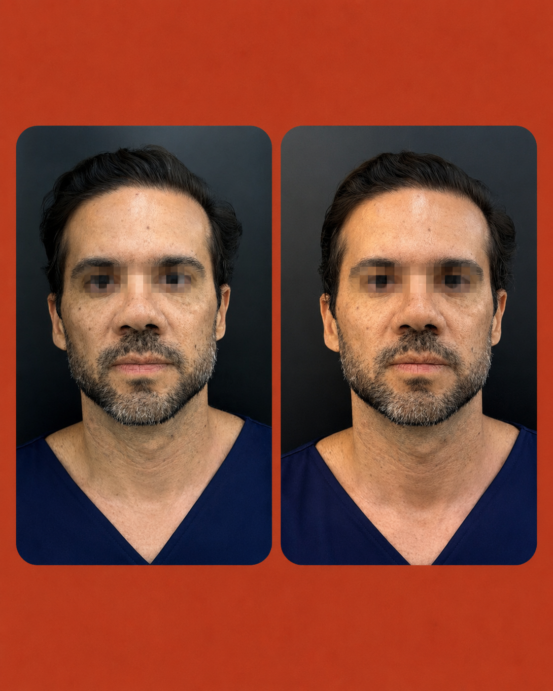 Resultado 1
