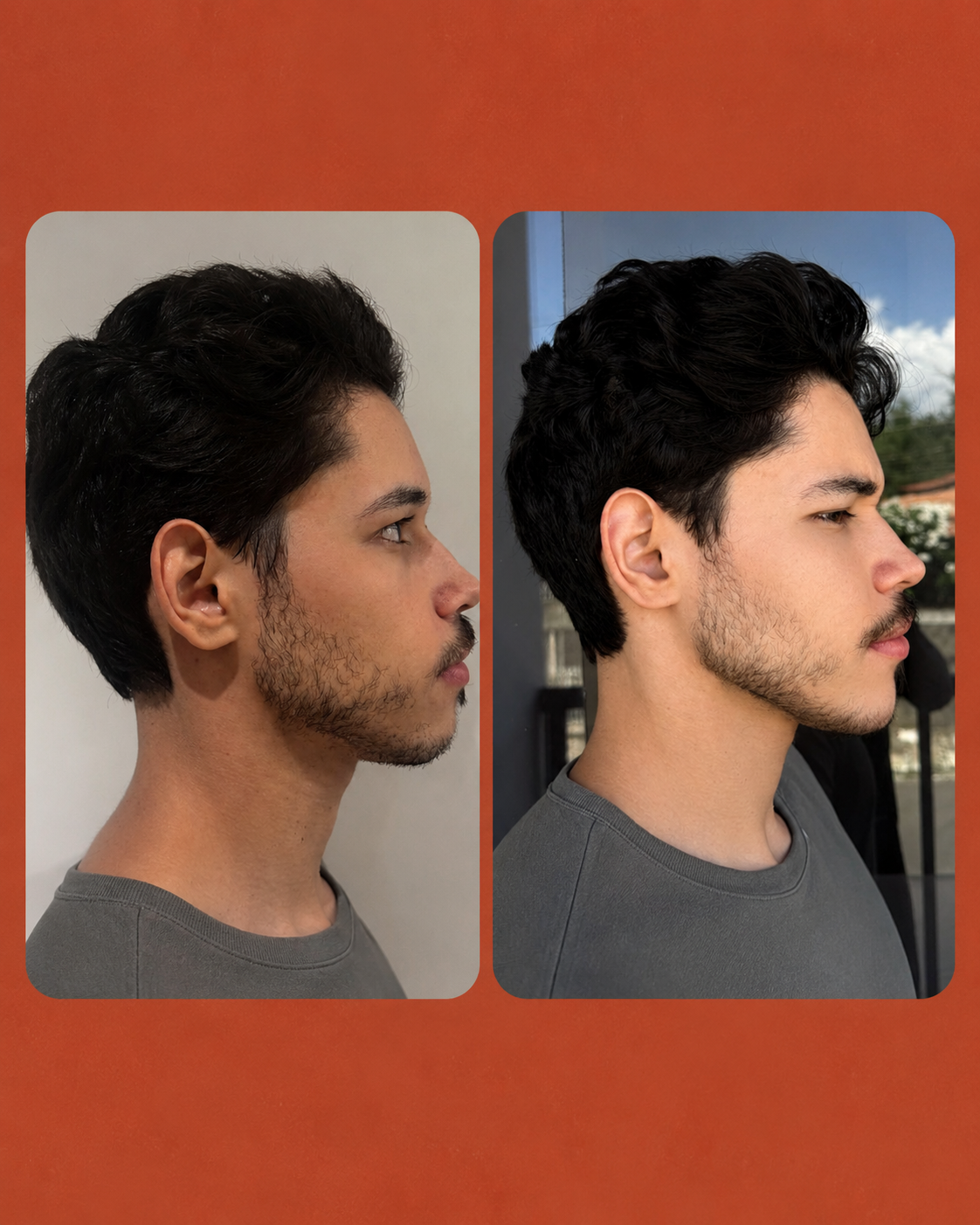Resultado 2