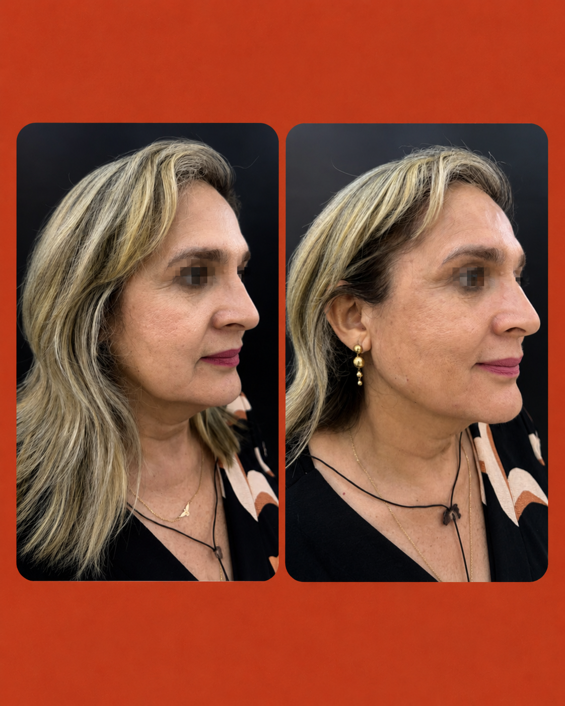 Resultado 3