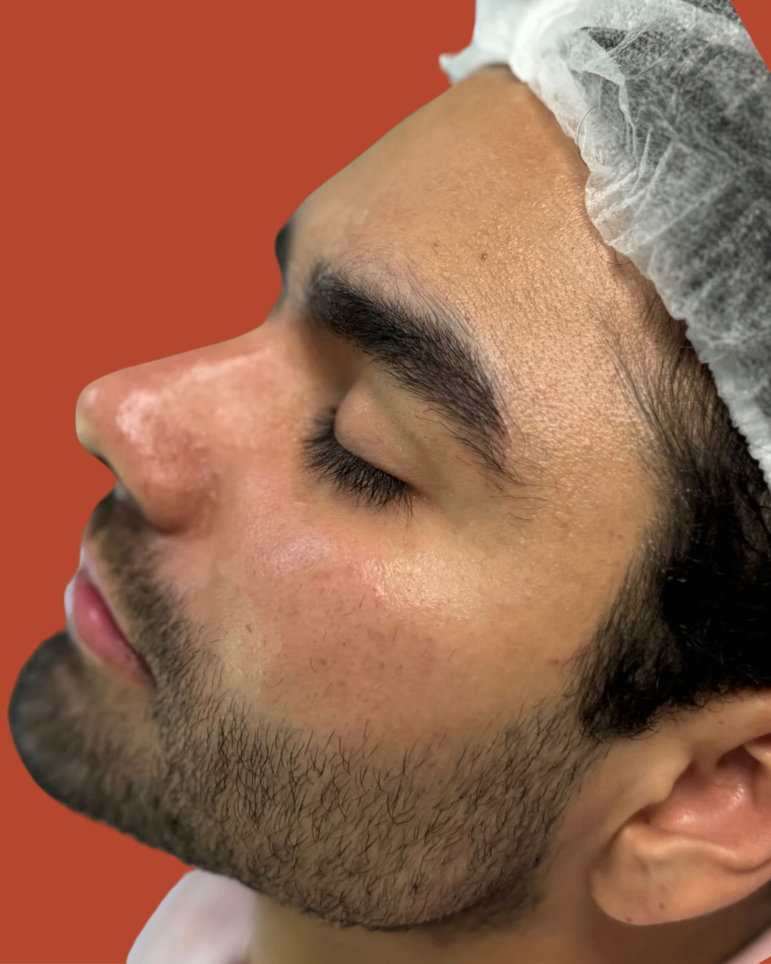 Resultado 4
