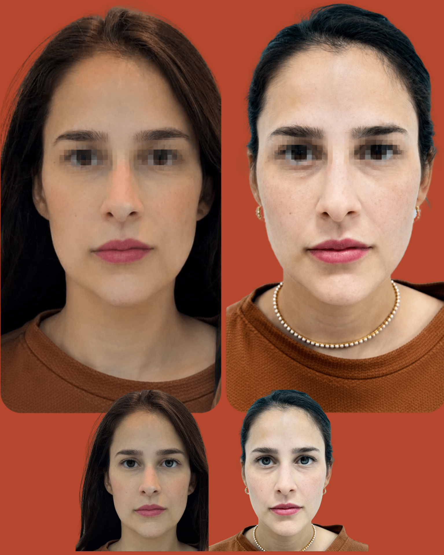 Resultado 8